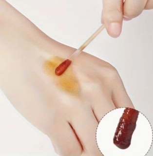 Jednorázové jodové tampóny 50ks